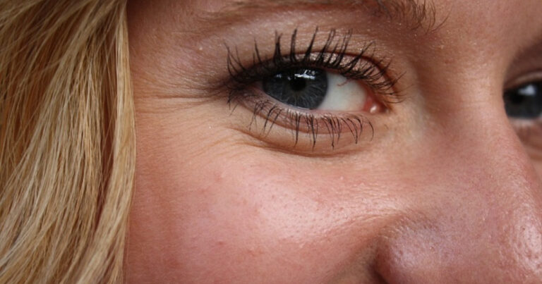 How to Reduce Crow’s Feet? 8 Effective Methods